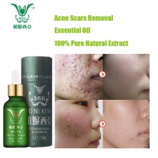 Face Care Essential Oil Acne Scar Spots Removal Skin Care Whitening Remove Scars Acne Repair Face Cream Essence Acne Treatment